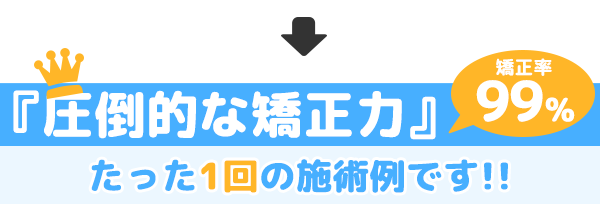 巻き爪あきらめてませんか？簡単に改善できます。施術も痛くない